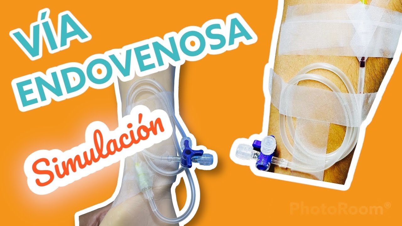 Via Endovenosa (Canalizar) - Demostración