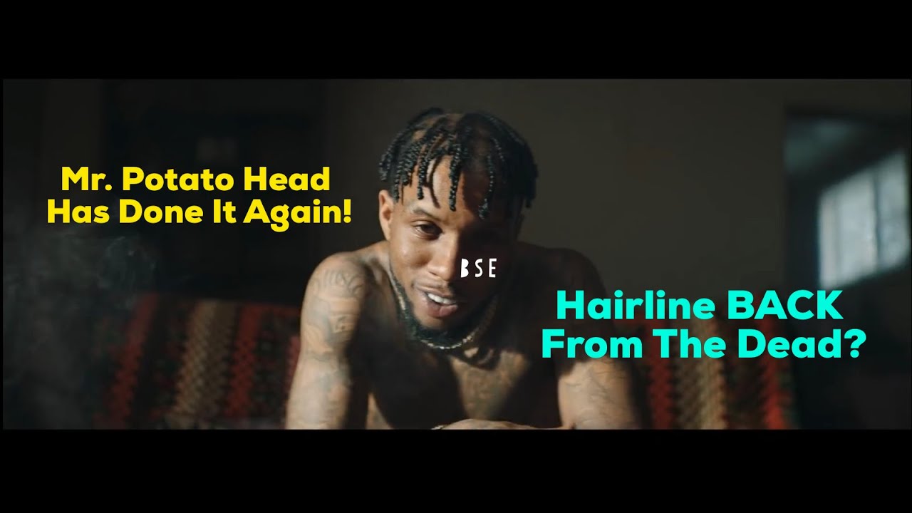 The Evolution Of Tory Lanez' Hairline