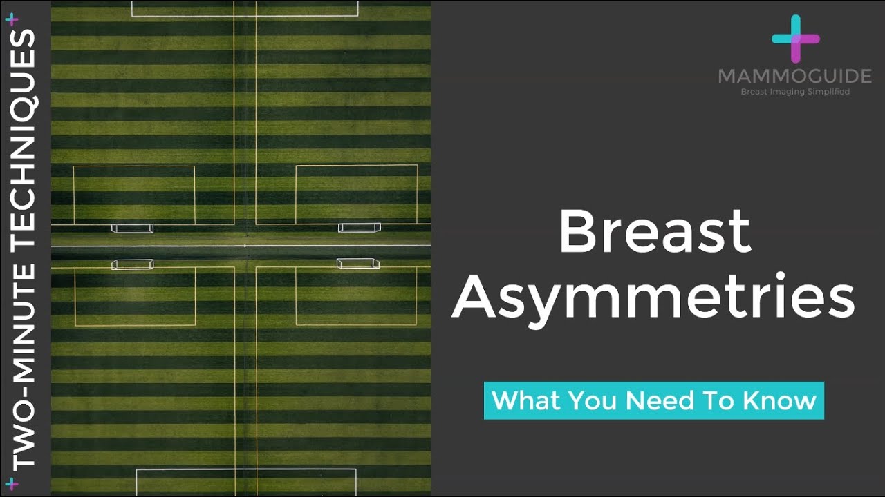 Two Minute Techniques - Breast Asymmetries