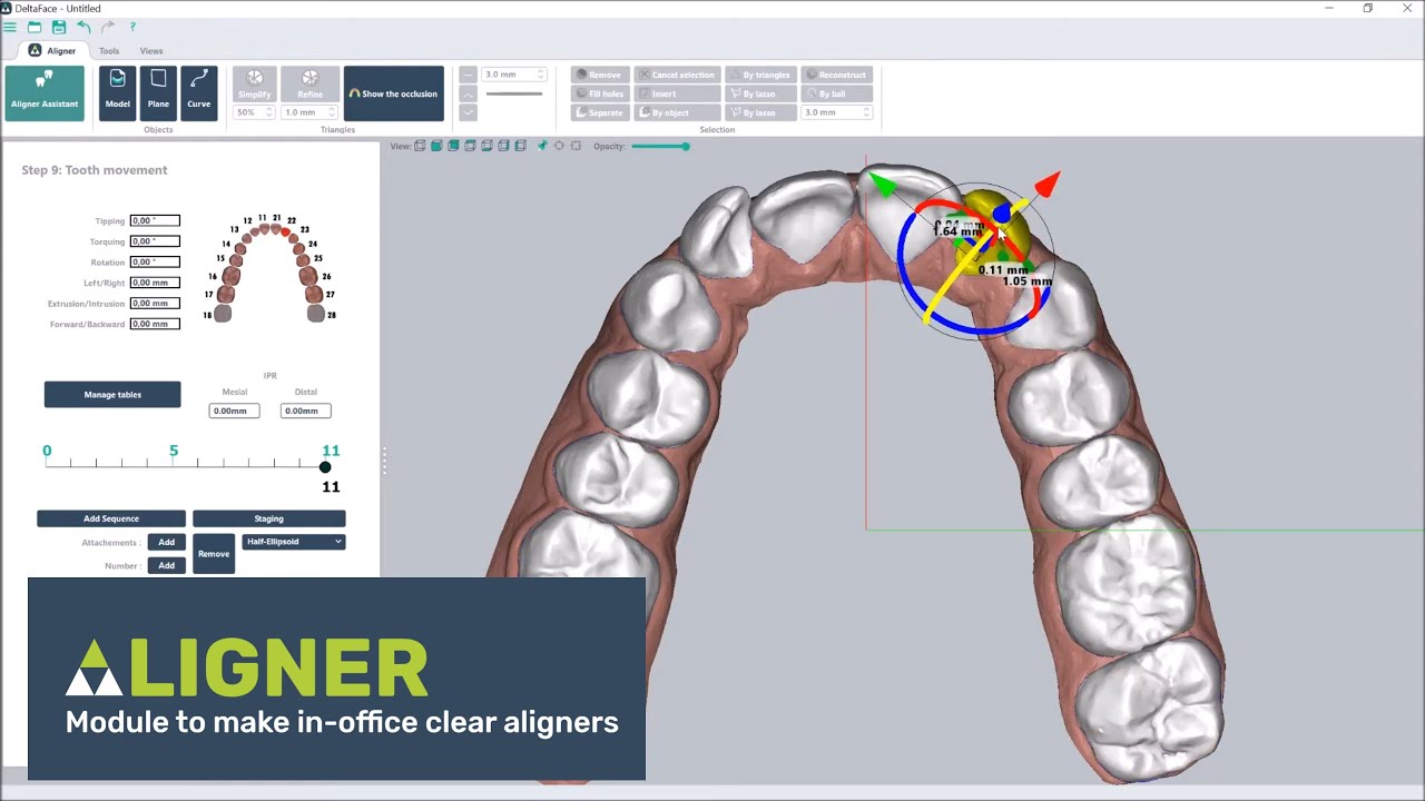 Clear aligner software: thermoforming or direct printing