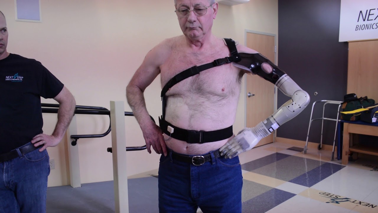 Luke Arm Video