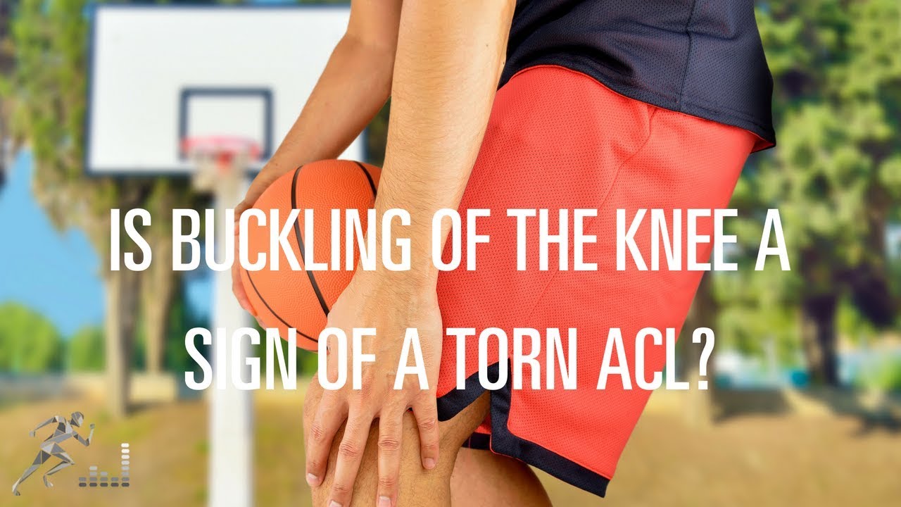 Is my knee giving out a sign of an ACL injury?