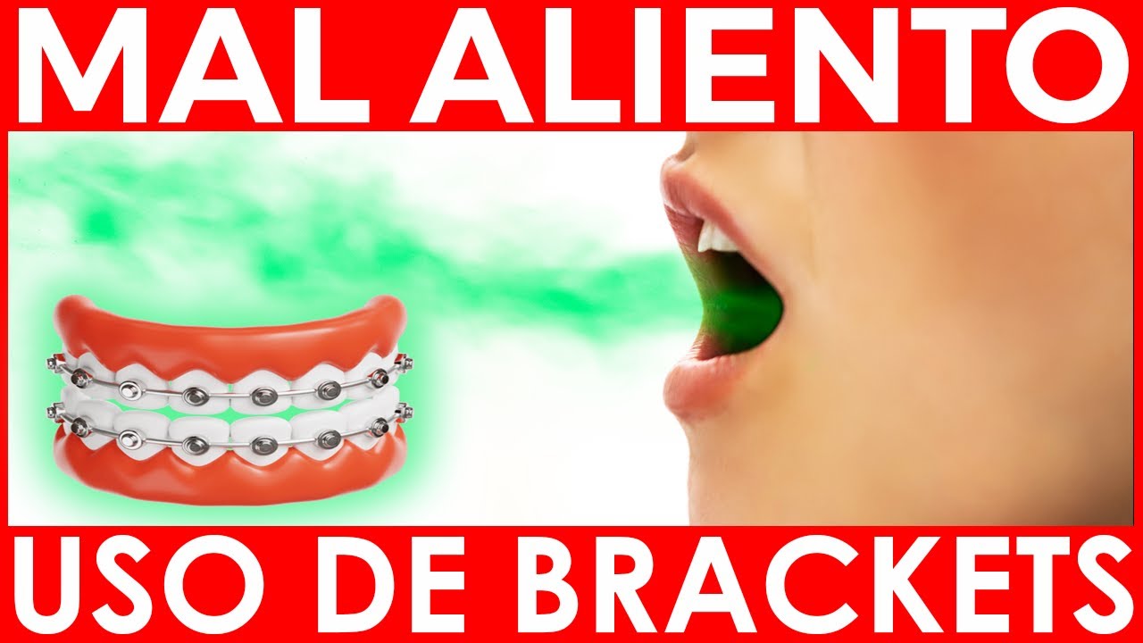 &iquest;C&oacute;mo QUITAR el MAL ALIENTO por los Brackets? Consejos para eliminar y evitar el mal aliento