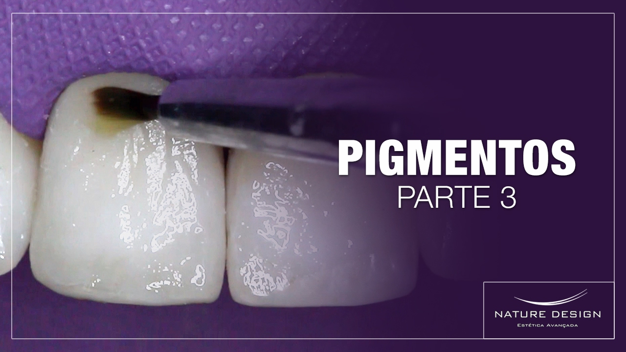 Pigmentos em Dentes Escurecidos. Parte 3: Caracterização Cervical | Leonardo Muniz