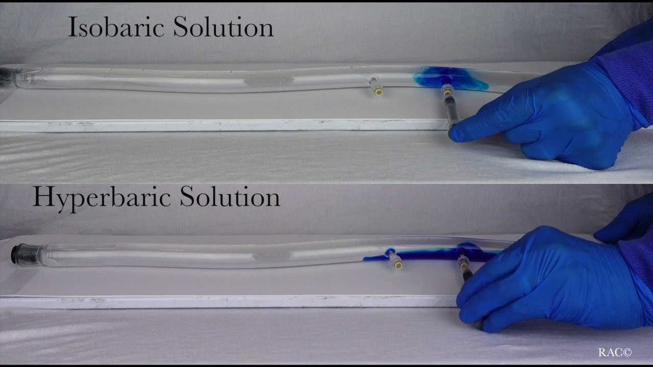 Glass Spine Model Demonstrating Local Anesthetic Baricity for Hyperbaric and Isobaric Solutions