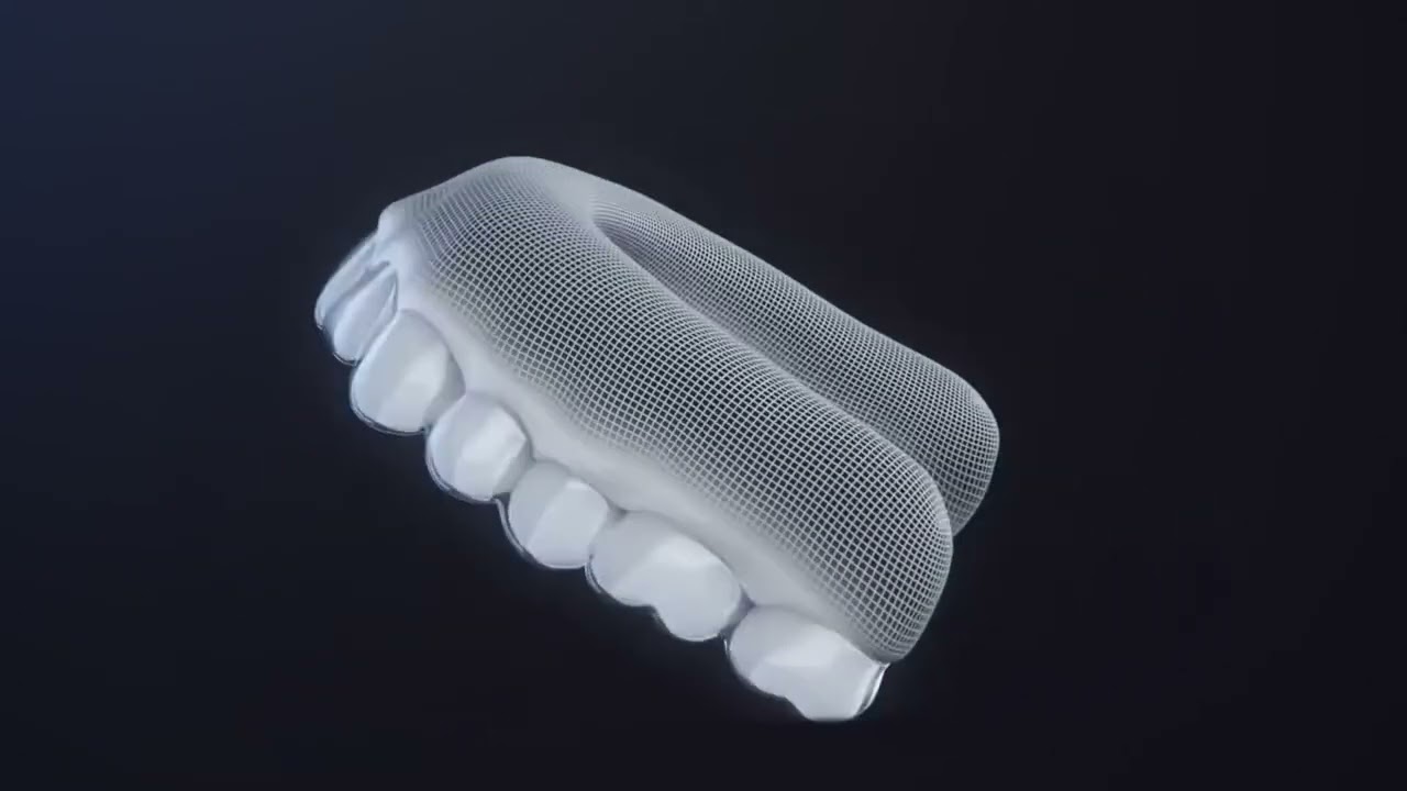 Thinking of Getting Invisalign? Here’s What You Should Know Before You Start!