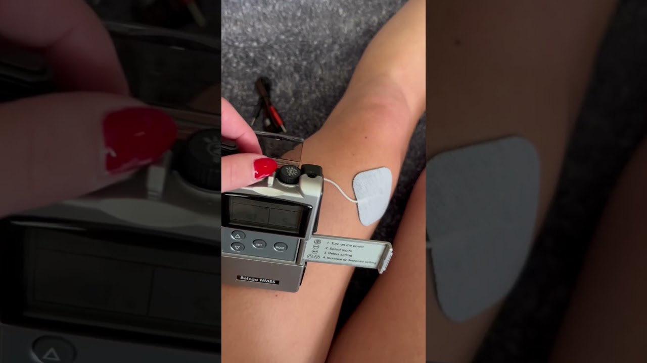 Balego NMES stim unit how to use for quad activation #quadsquad #aclrecovery