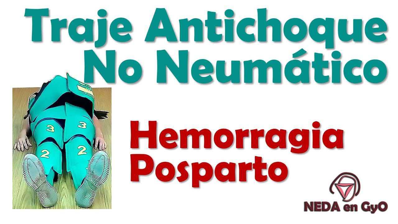Hemorragia Posparto. Traje Antichoque No Neumático TANN. Explicación PRÁCTICA ¡Sencilla de entender!