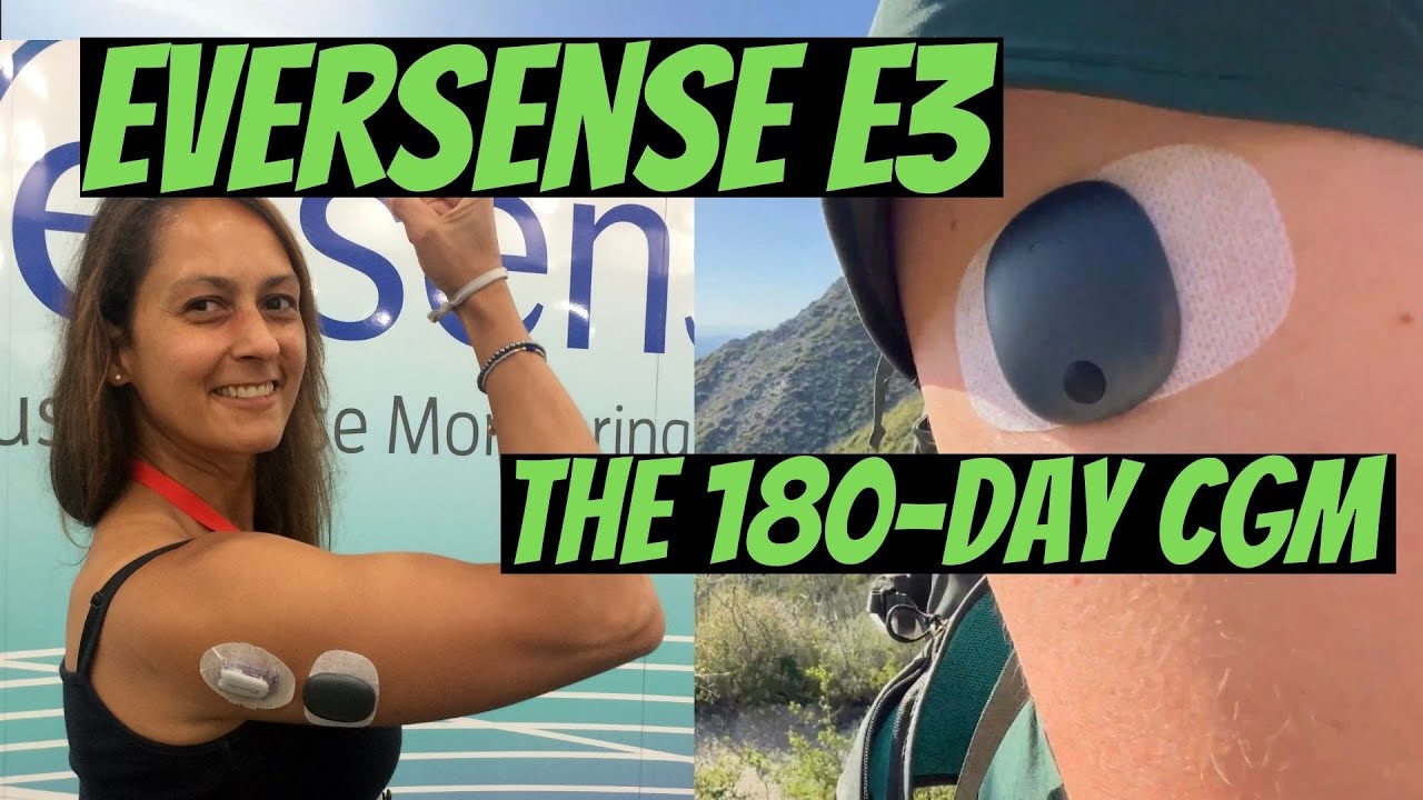 Eversense the 180-day Continuous Glucose Monitor (CGM)