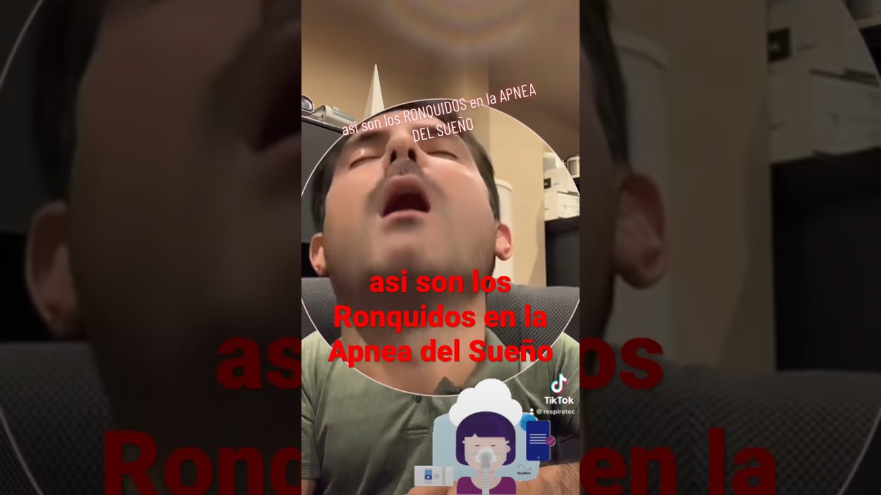 as&iacute; roncan los que tienen apnea del sue&ntilde;o #apneadelsue&ntilde;o #cpap #ronquidos
