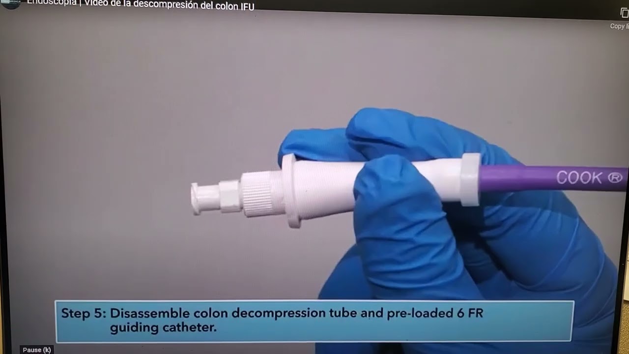 Cook decompression tube set up