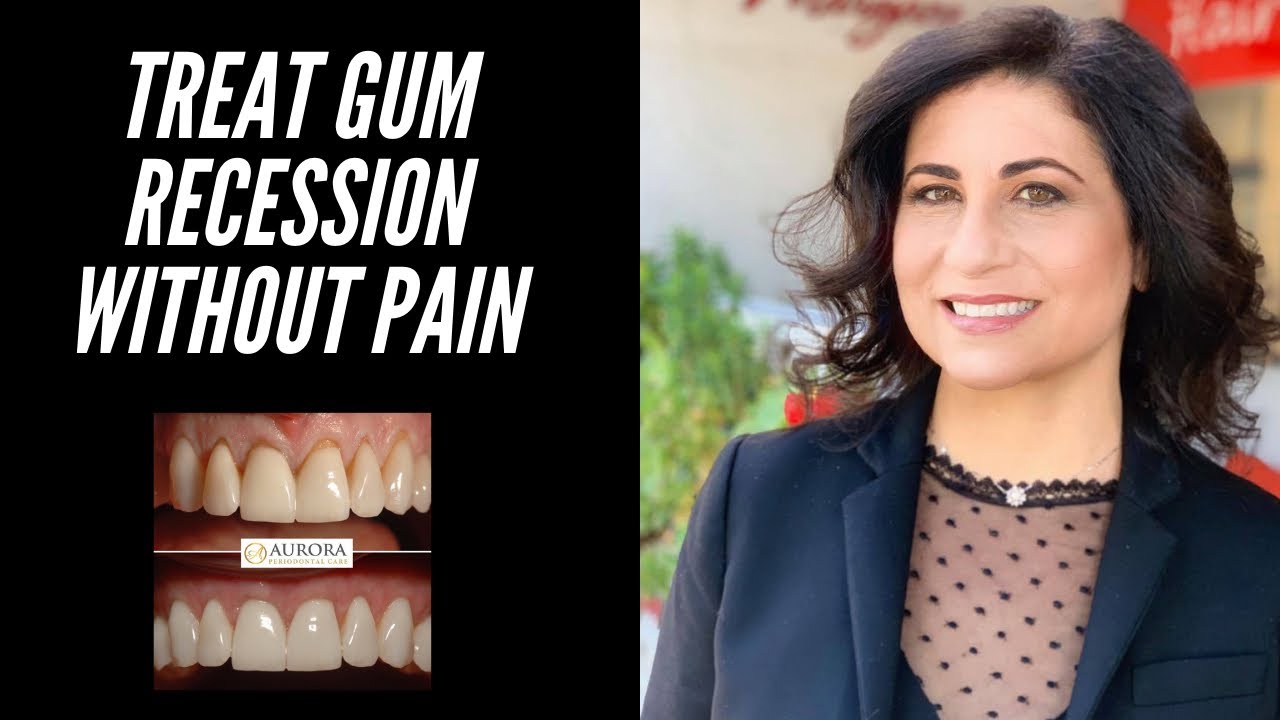 Minimally Invasive Treatment for Gum Recession with AlloDerm