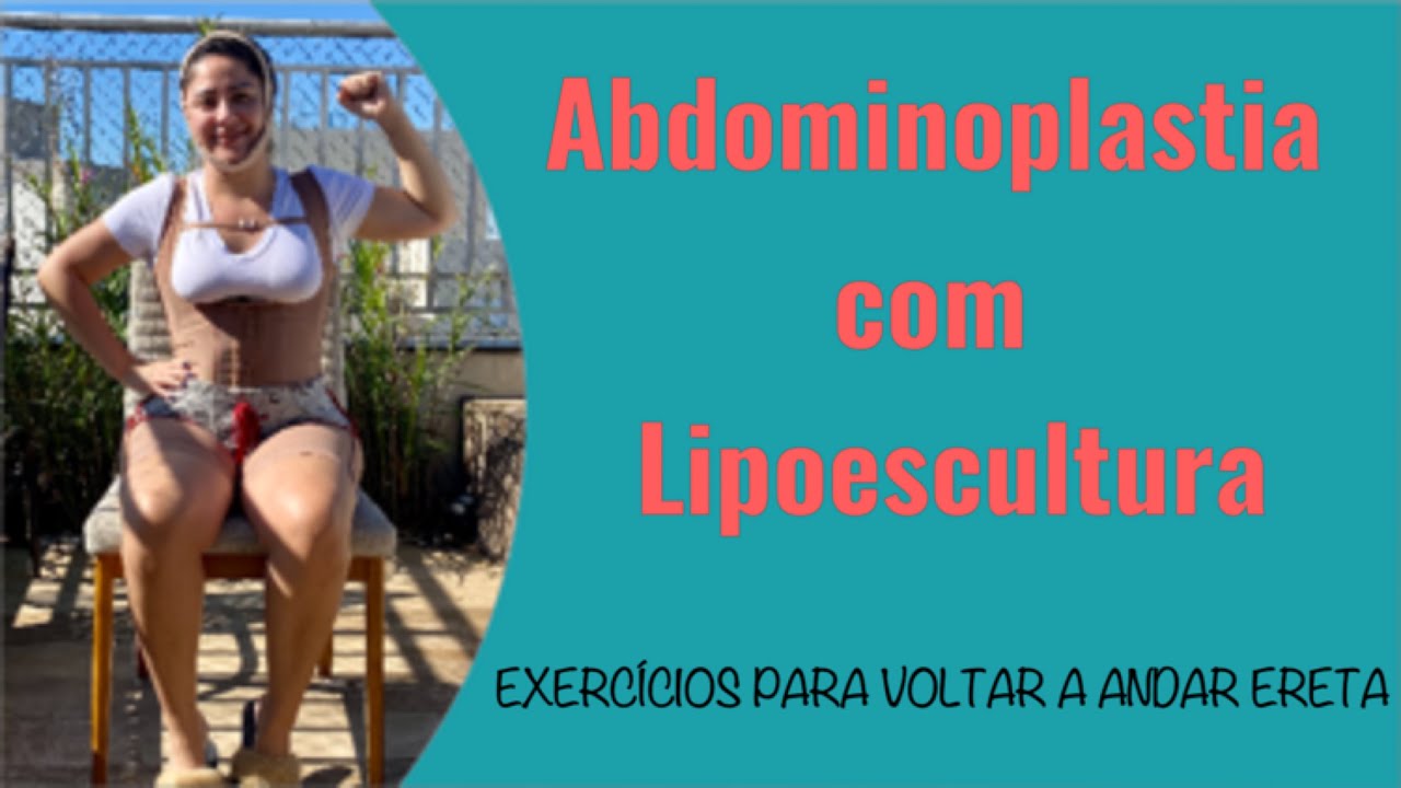 Exercícios para voltar a andar ereta | abdominoplastia com lipoescultura | por Thaís Ortiz