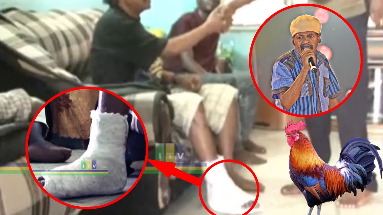 Kuku wa ndotoni amvunja mguu Hussein Jumbe.