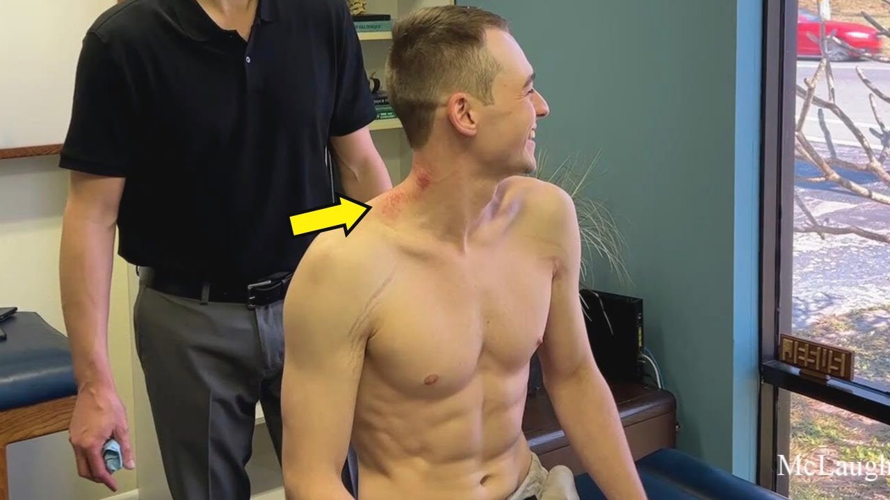 *Shocking* Transformations! Frozen Necks Finally Release 😭 After Intense Cracks & Massage