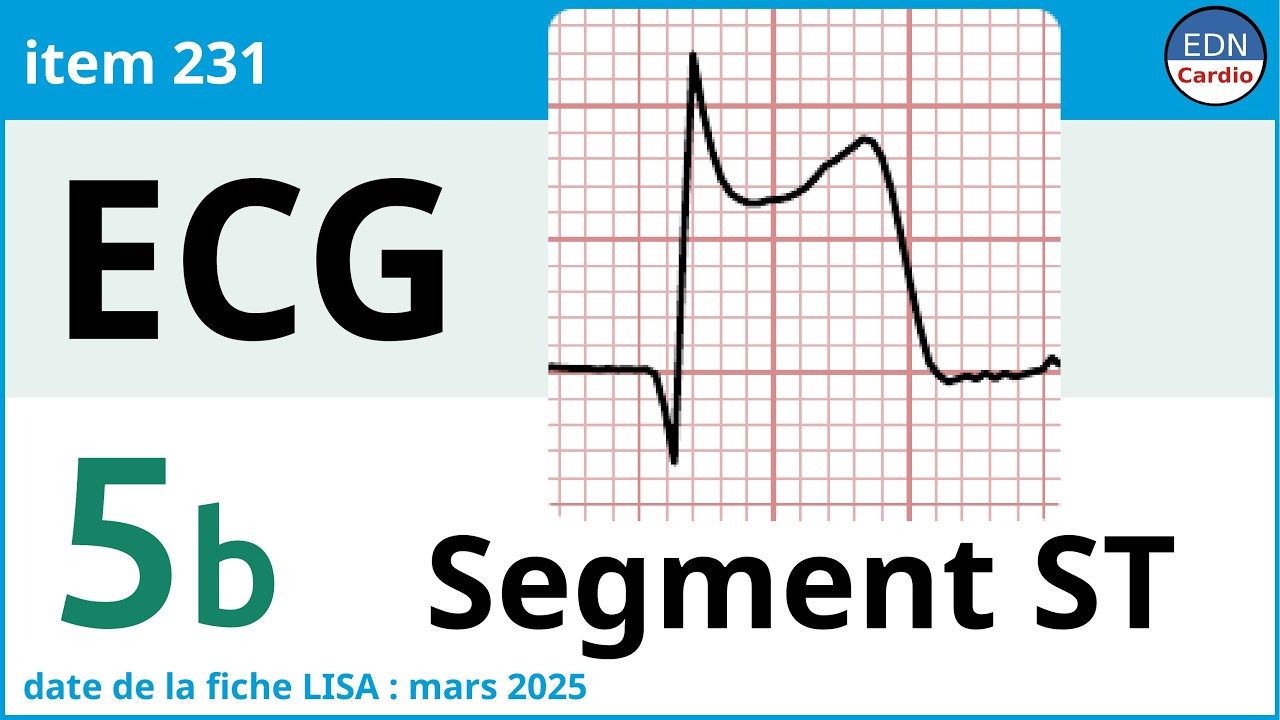 231 - Electrocardiogramme (ECG) - Partie 5b - Physiopathologie du segment ST