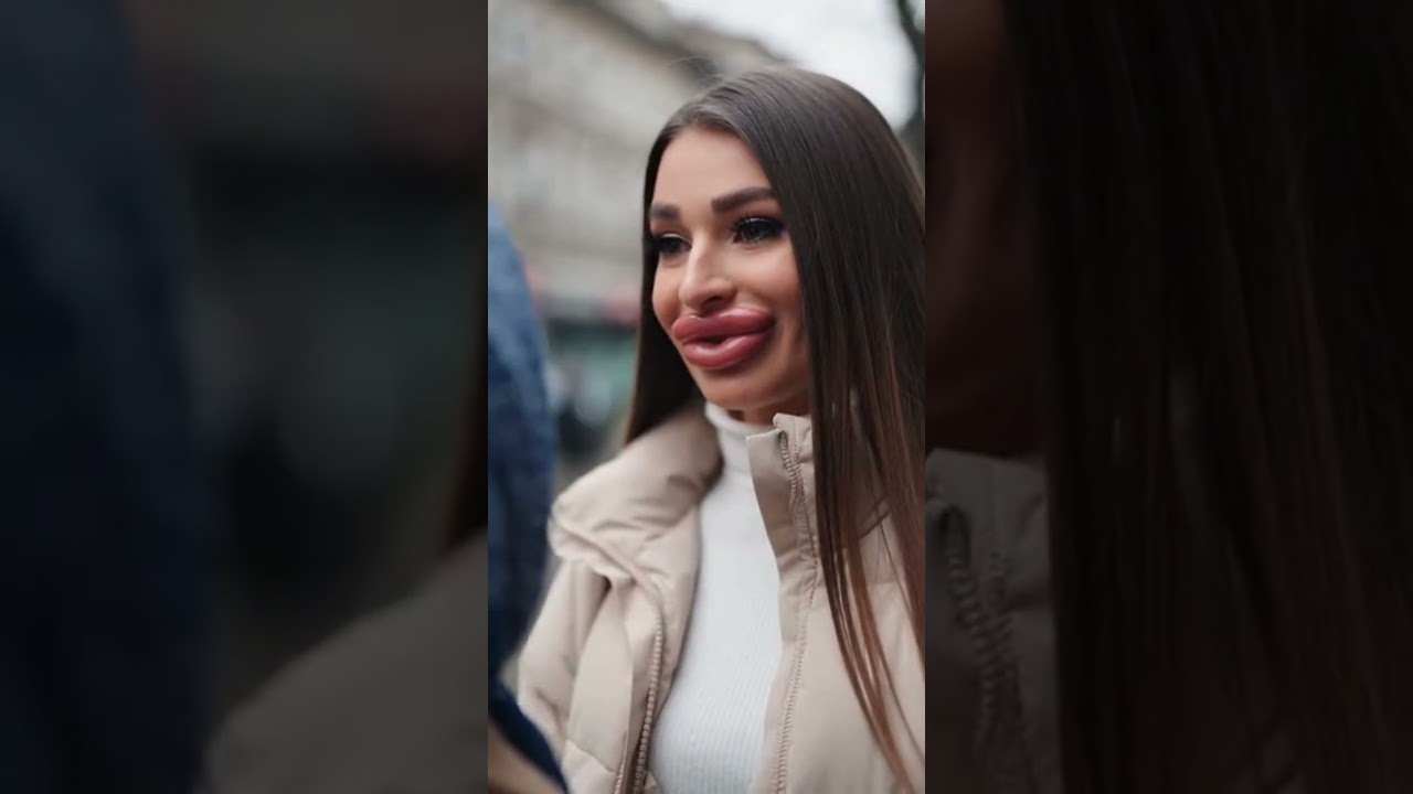 A i nije ti neka moda, ko da te roj pčela izujedao 🤣🤣🤣 