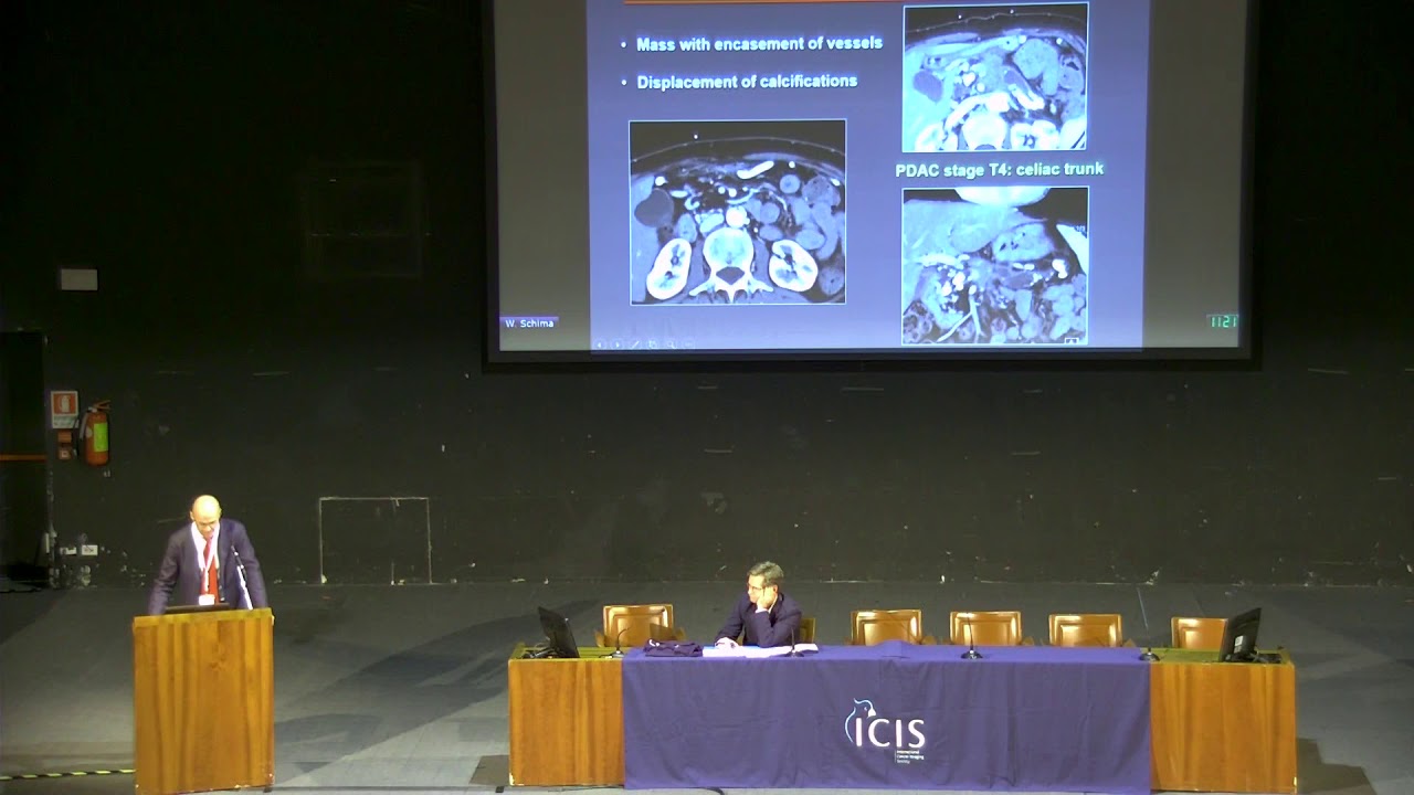 Pancreatic ductal adenocarcinoma versus mass forming pancreatitis delivered by Prof. Wolfgang Schima