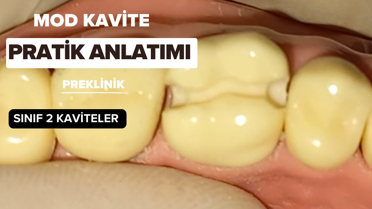 2. SINIF KAVİTELER (MOD) PRATİK ANLATIMI