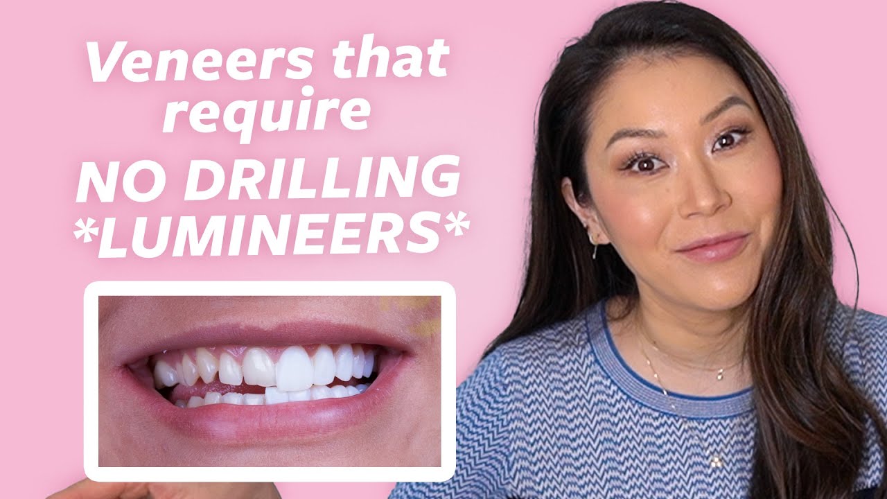 Lumineers vs. Veneers | What are 