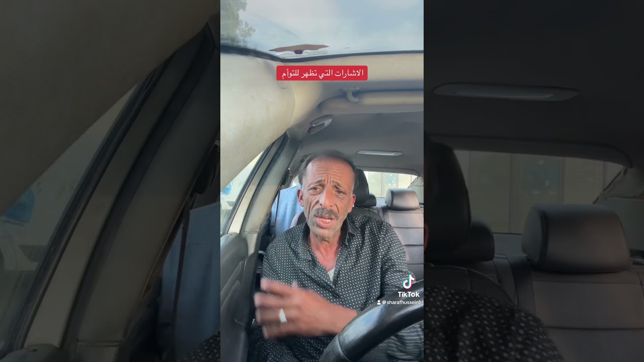‏الإشارات التي تظهر أمام توأم الشعله