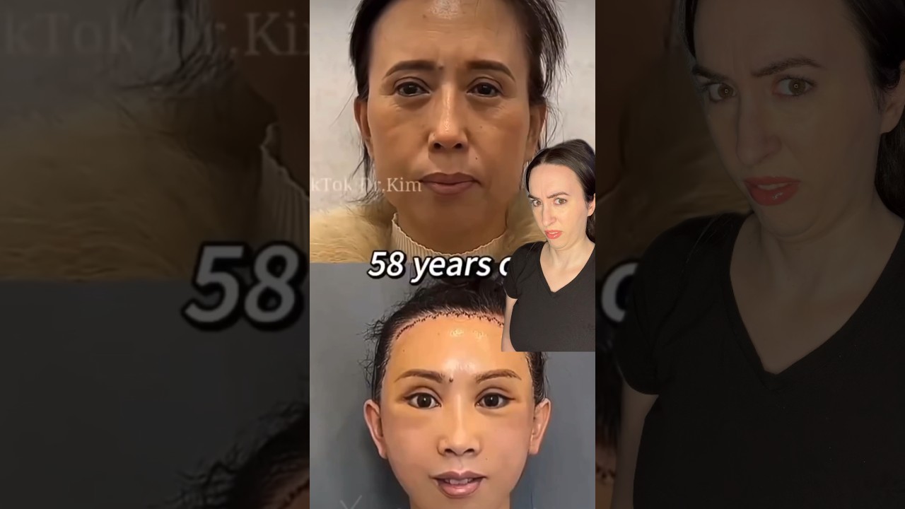 Goofy ahh Tik Tok plastic surgeon Dr Kim 🤨
