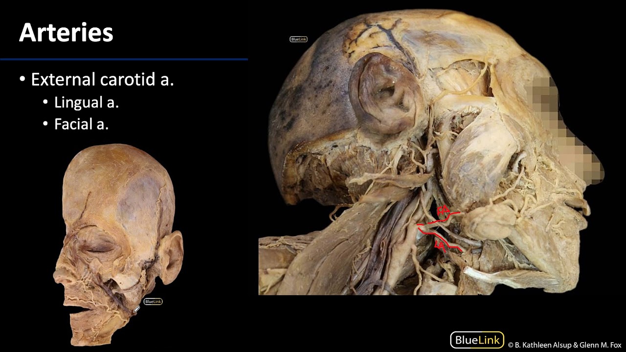 Parotid and Submandibular Triangle - Arteries