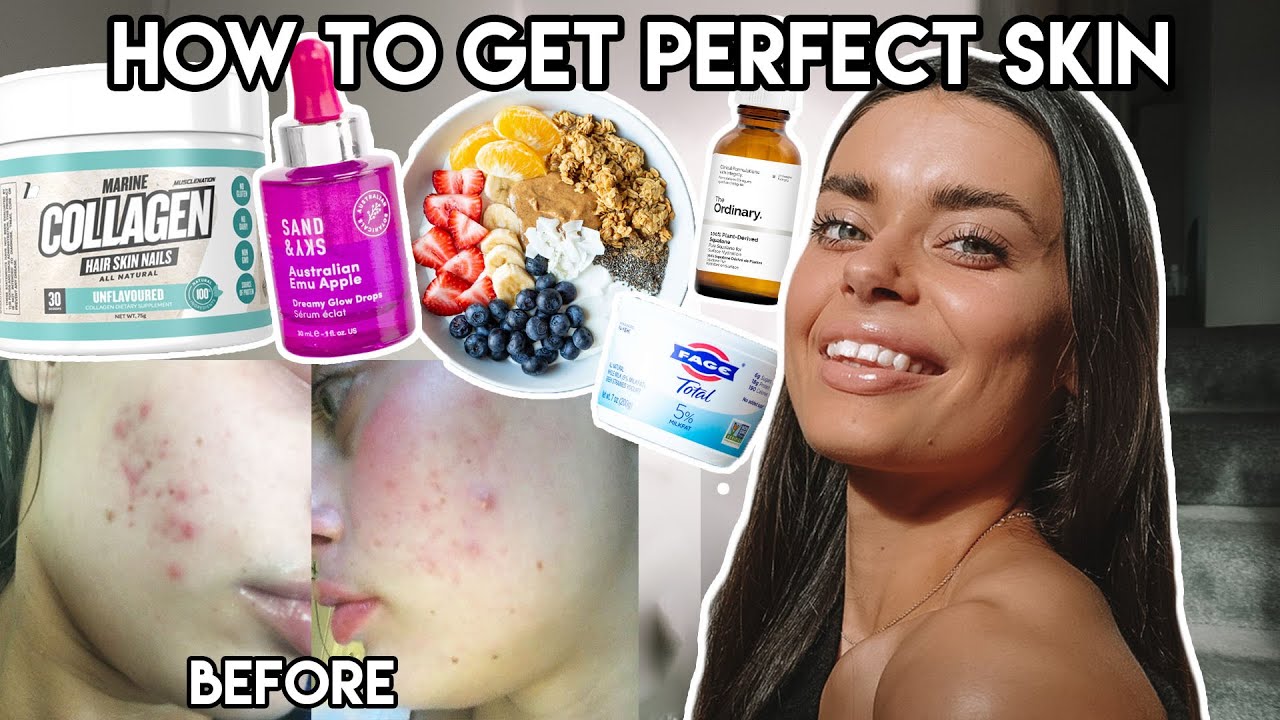 My Formula for PERFECT Clear Skin | Daily Skincare Routine, Supplements & Diet