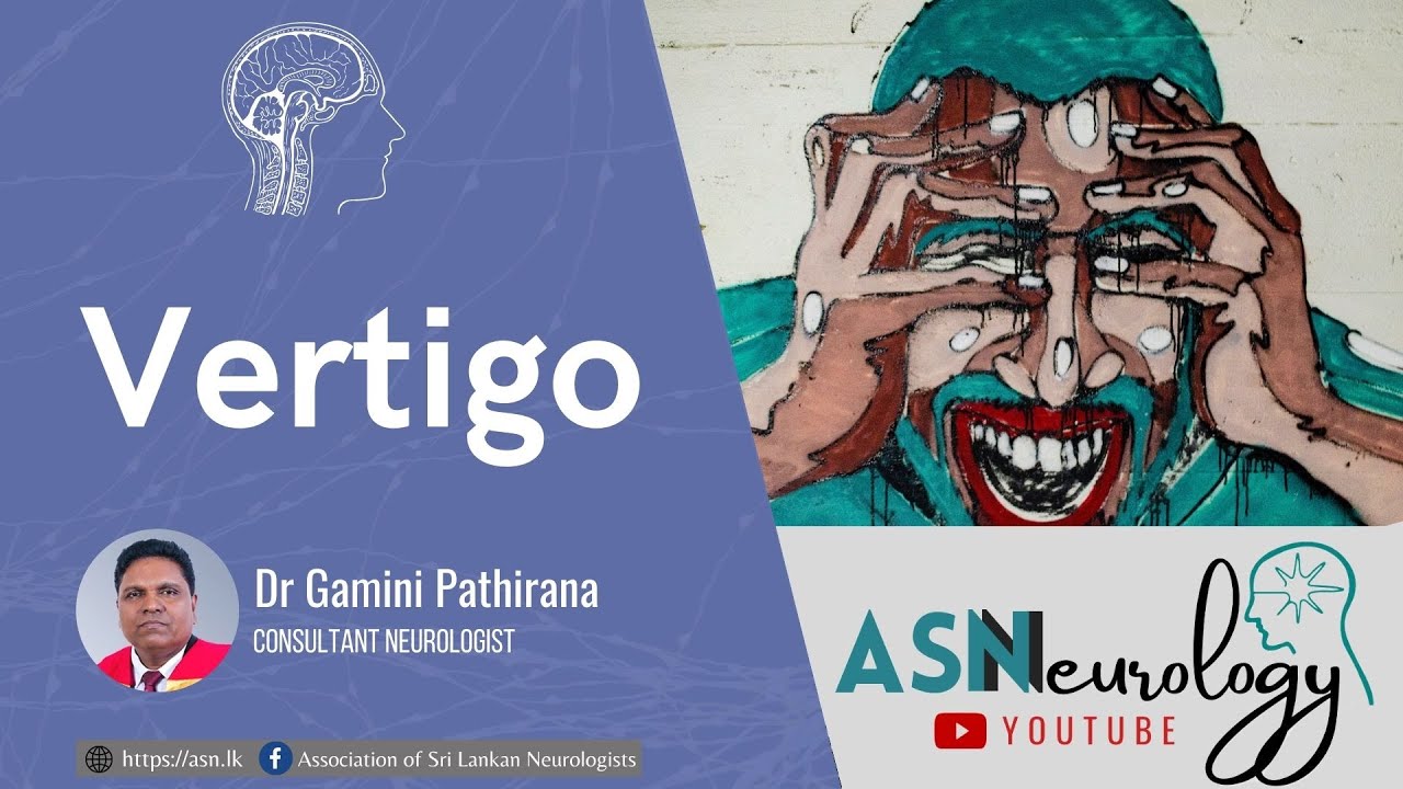 Vertigo by Dr Gamini Pathirana