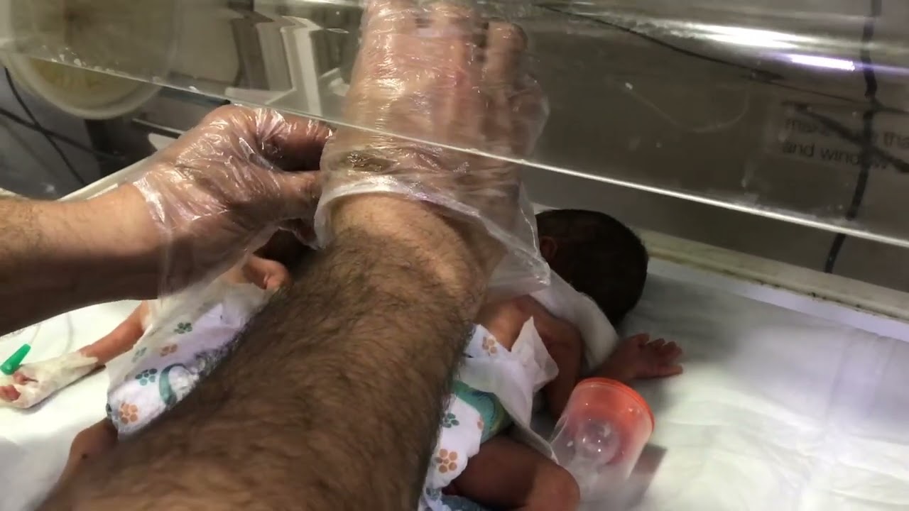 Newborn babies 1st feeding after delivery through tube #hospital #nicubaby #feeding #cutebaby 