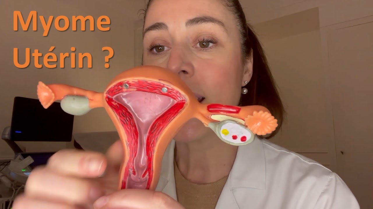 Le myome utérin, Qu'est ce que c'est? Une explication visuelle