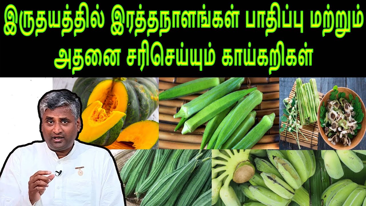 இருதயத்தில் இரத்தநாளங்கள் பாதிப்பு மற்றும் அதனை சரிசெய்யும் காய்கறிகள் KAIGARIMARUTHUVAM @megatvindia