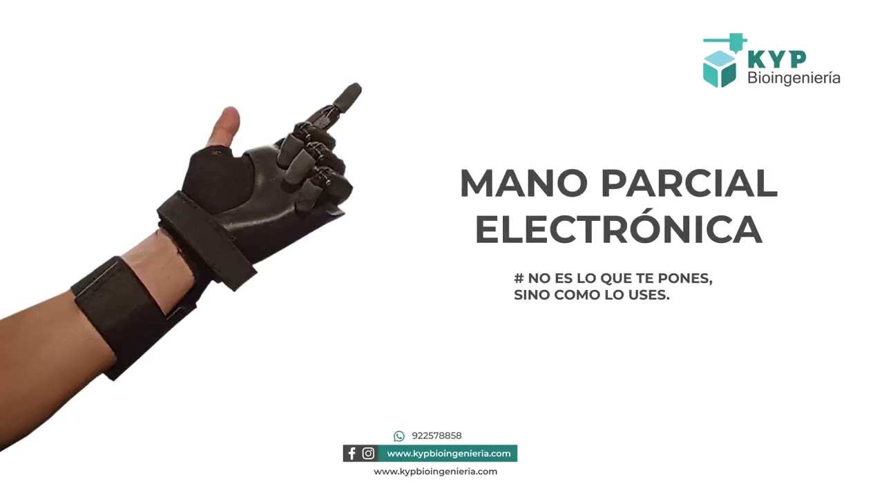 KyP Bioingenier&iacute;a  - PR&Oacute;TESIS MANO PARCIAL ELECTR&Oacute;NICA