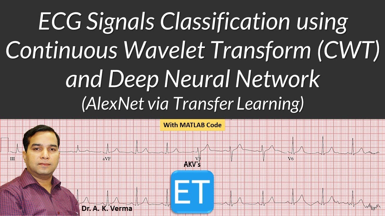 ECG Signals Classification using Continuous Wavelet Transform (CWT) and Deep Neural Network