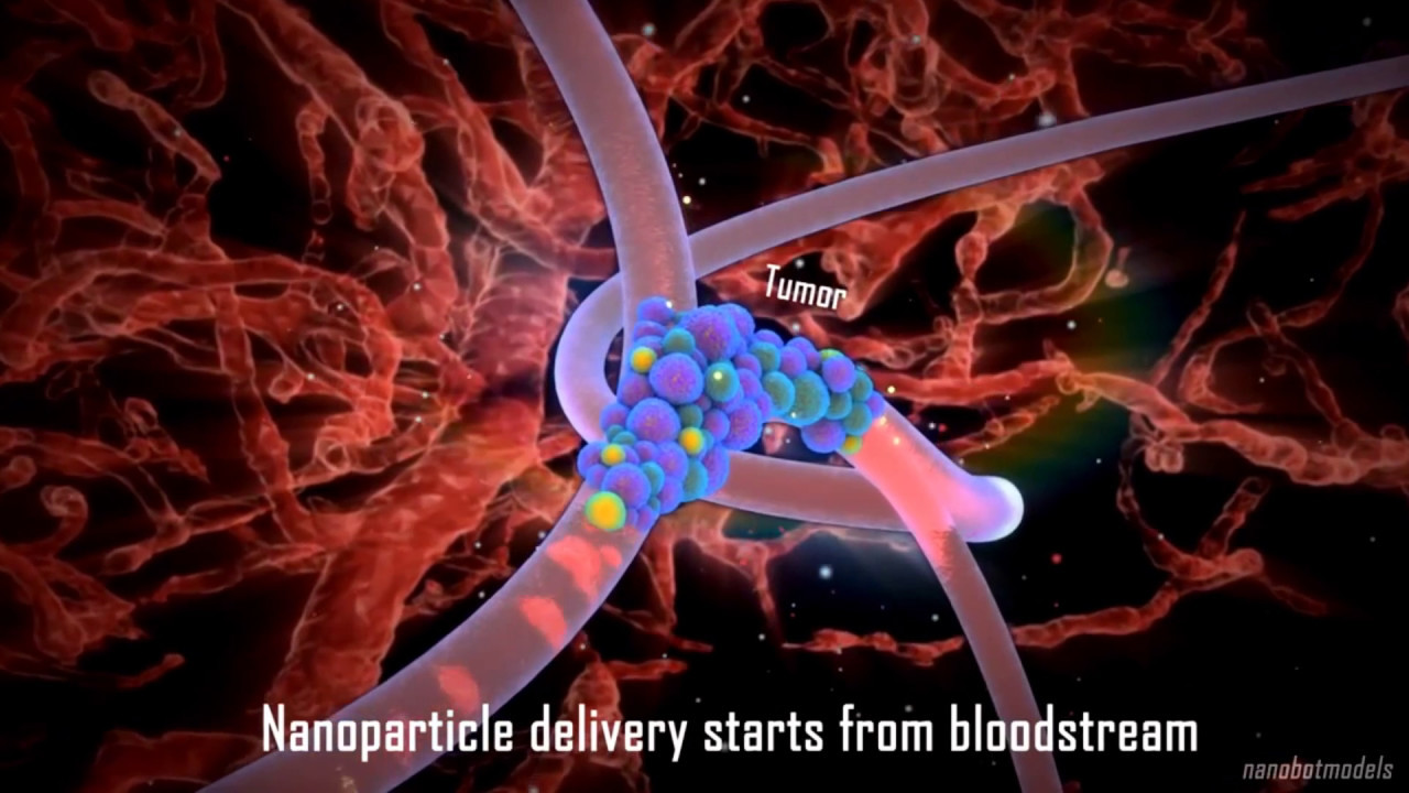 Gold Nanoparticles in Treatment of Prostate Cancer