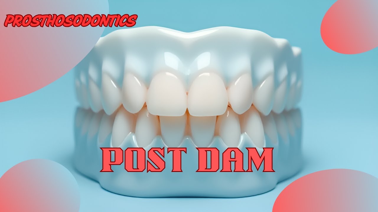 Prosthodontics Post Dam (Posterior Palatal Seal) (شرح  بالعربي)