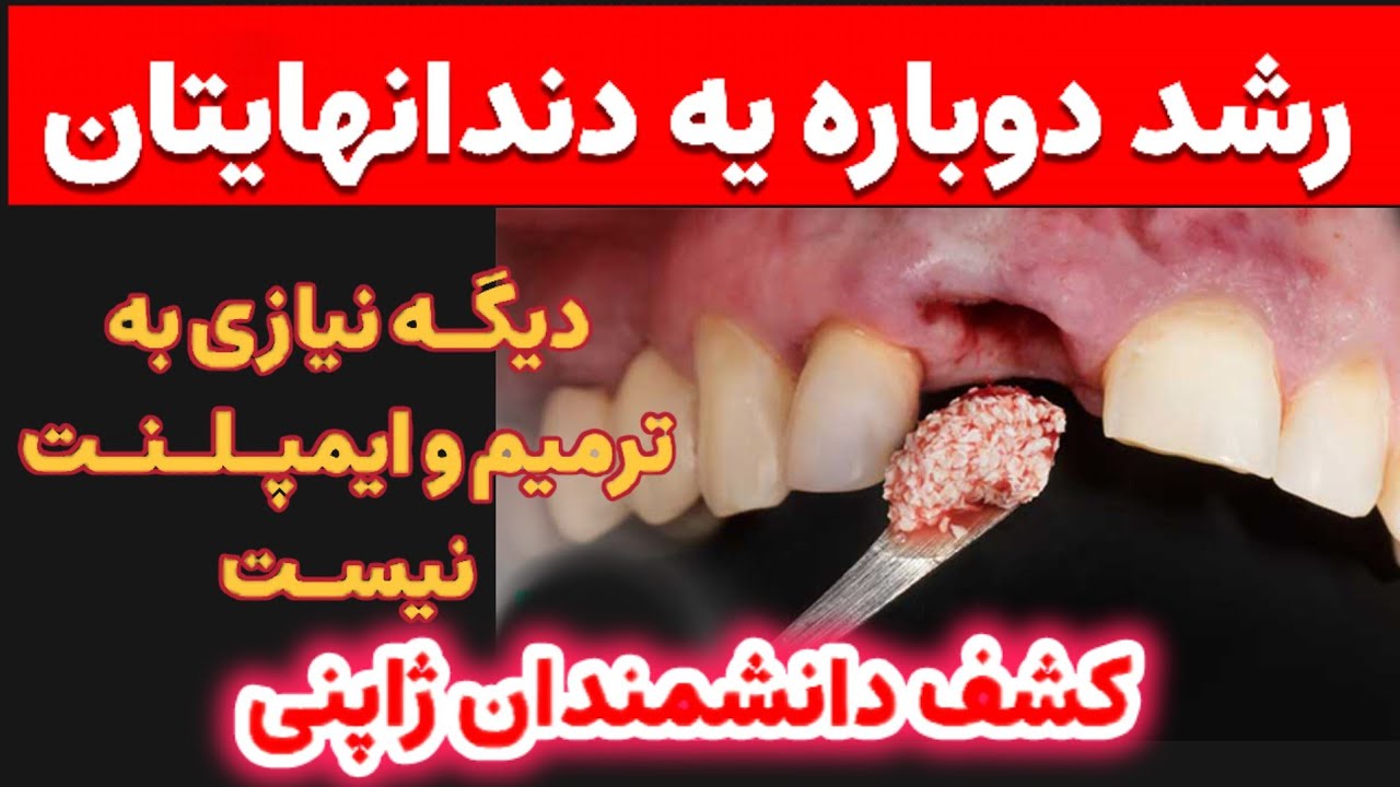 معجزه ژاپنی‌ها برای دندان‌های جدید! رشد دندان حتی بعد از ۷۰ سالگی 😱🦷 | تکنولوژی بازسازی دندان