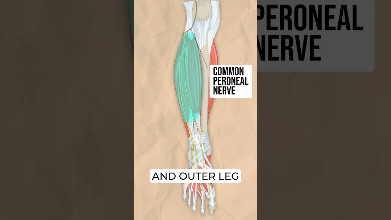 How It Works: Peroneal Nerve Palsy