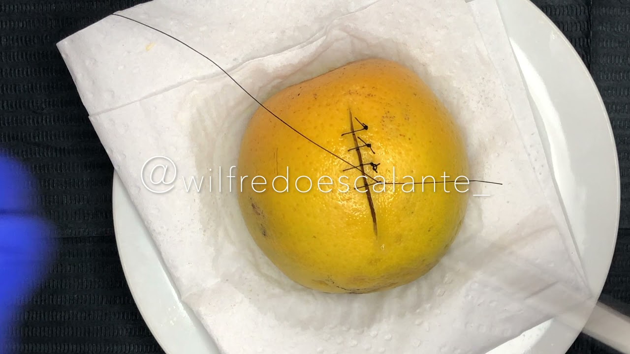 Procedimientos quirúrgicos periodontales PARTE II | Prof. Wilfredo Escalante Otárola