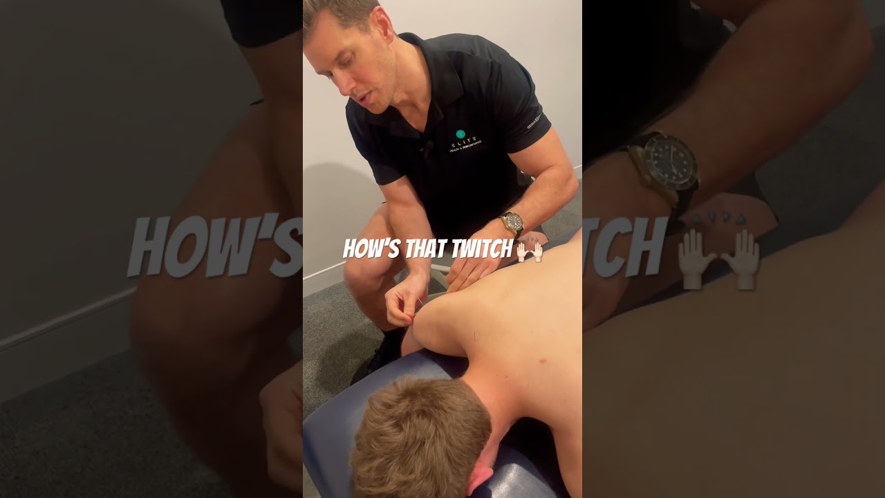 Deltoid muscle twitch satisfaction