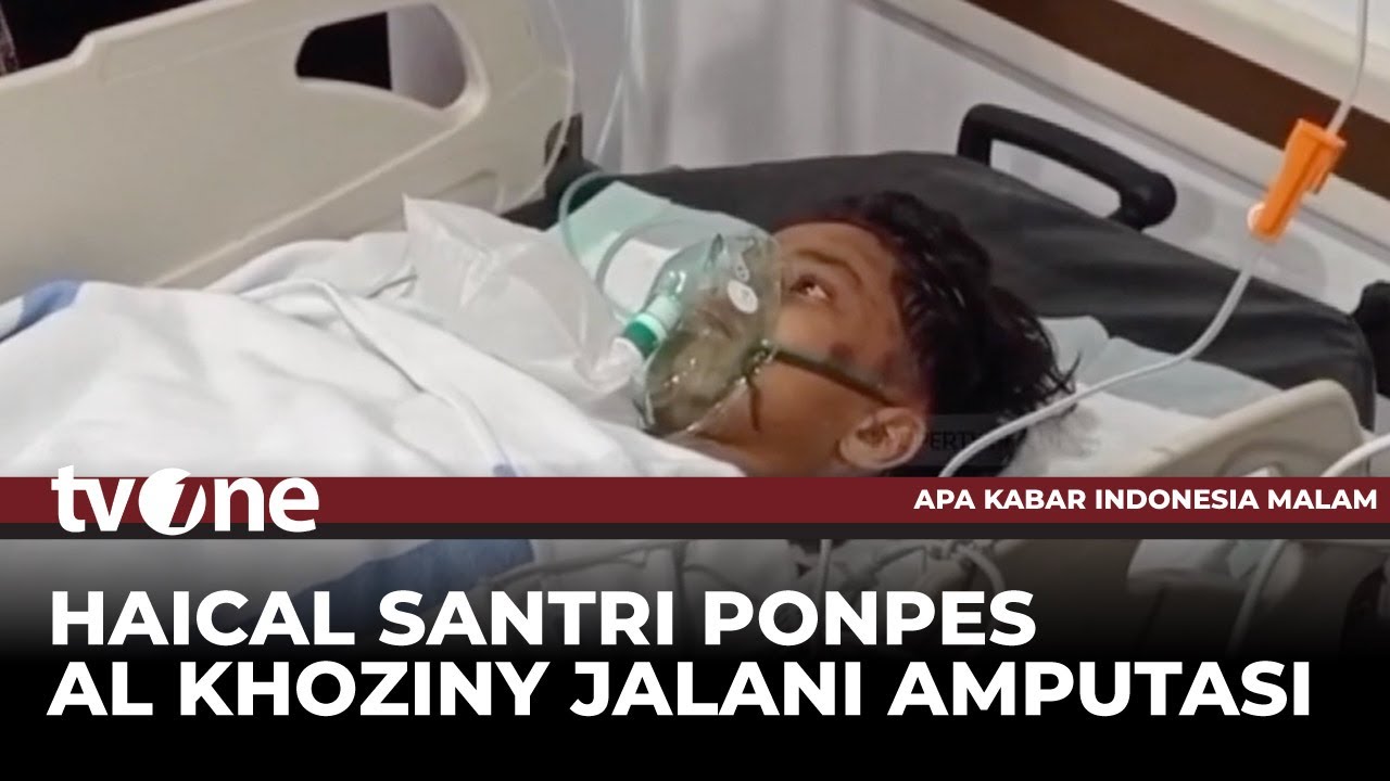 Korban Selamat Ponpes Al Khoziny Jalani Amputasi Kaki Kiri | tvOne