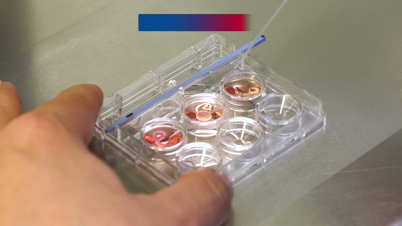Embryo Vitrification Closed System - The Cryotop Method