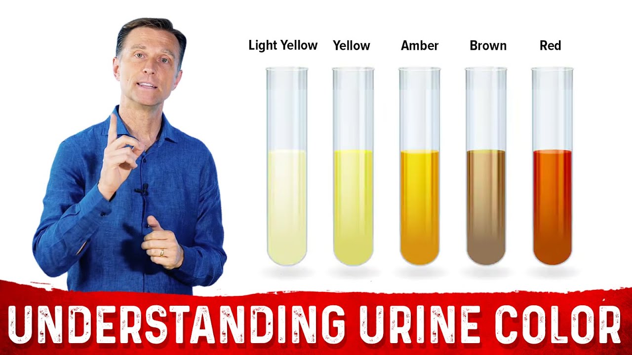 What Urine Color Indicates About Your Body &ndash; Dr.Berg