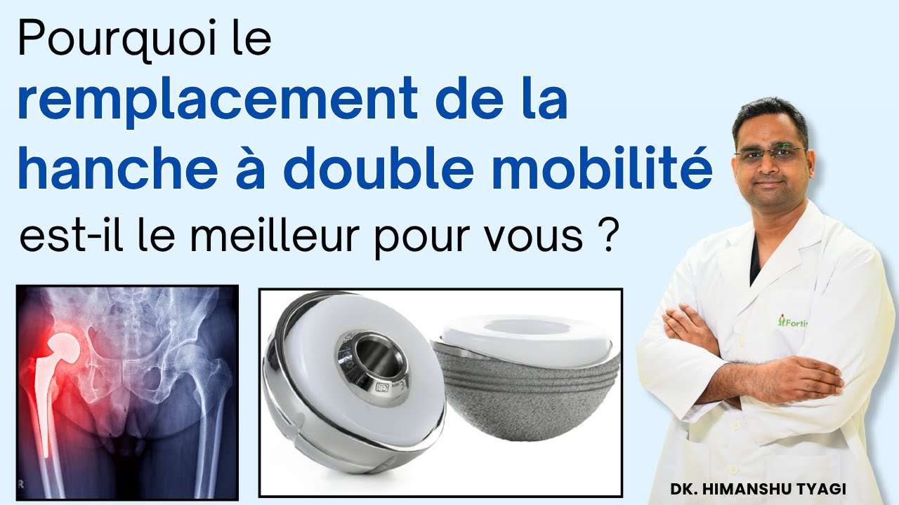 Pourquoi le remplacement de la hanche à double mobilité est-il le meilleur pour vous ? 
