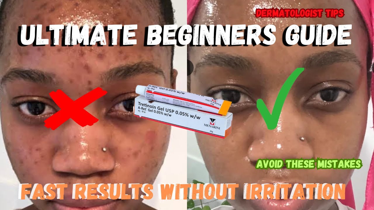 Tretinoin Mistakes You’re Making‼️Dermatologist Tips 🔥to Avoid Irritation & Boost Results✨ (2025)