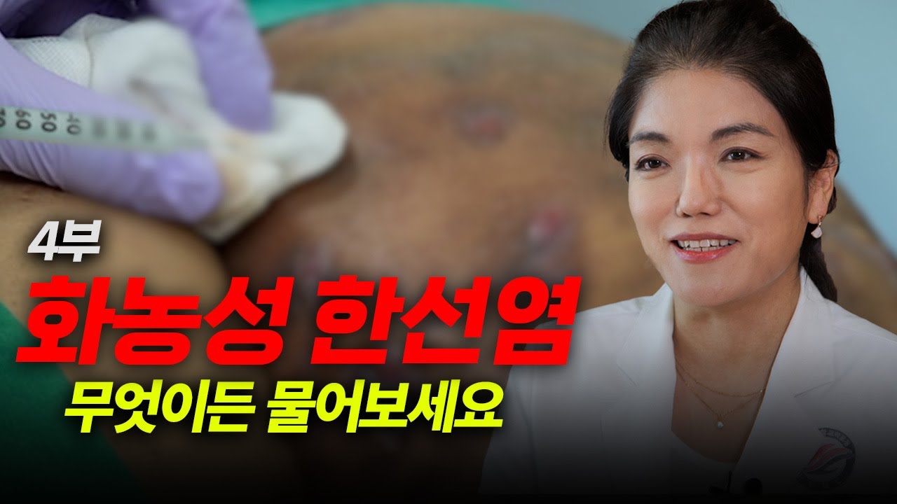 정확하고 확실한 화농성 한선염에 대한 정보, 여기서 알려드립니다