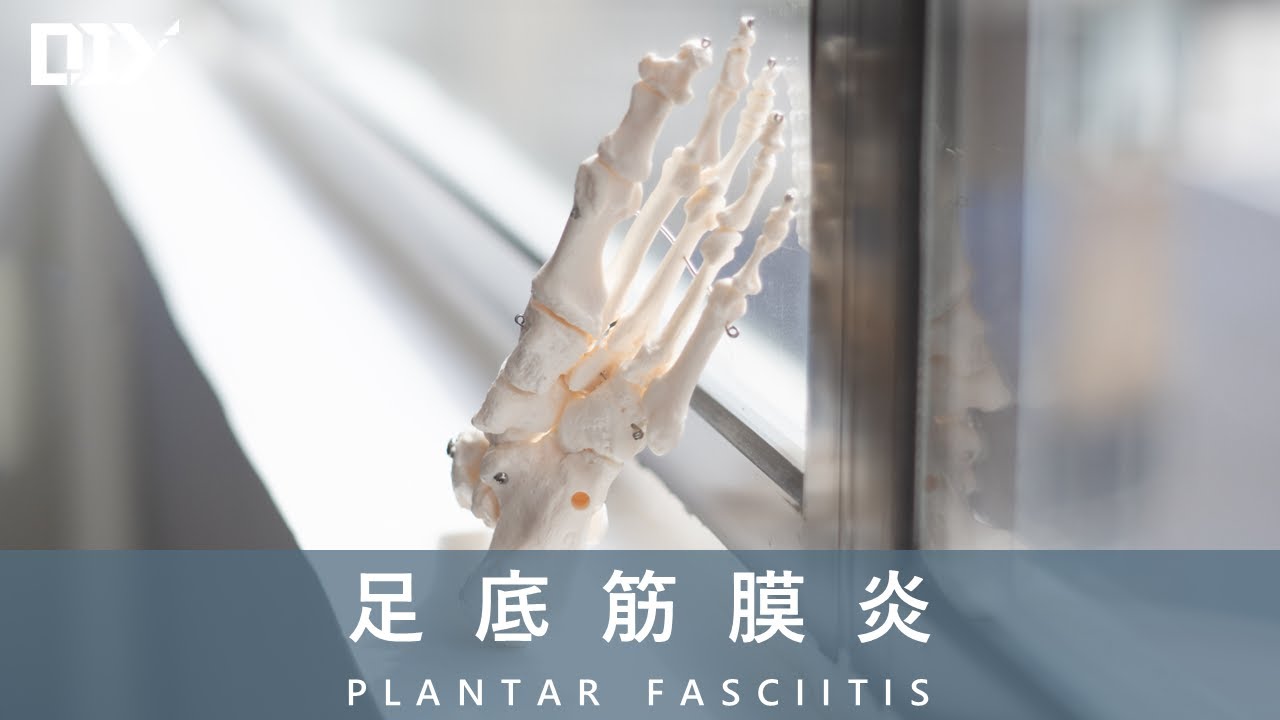 足底筋膜炎│DIY 教室