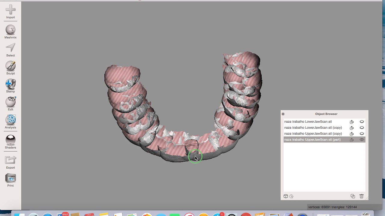Placa miorrelaxante confeccionada no meshmixer
