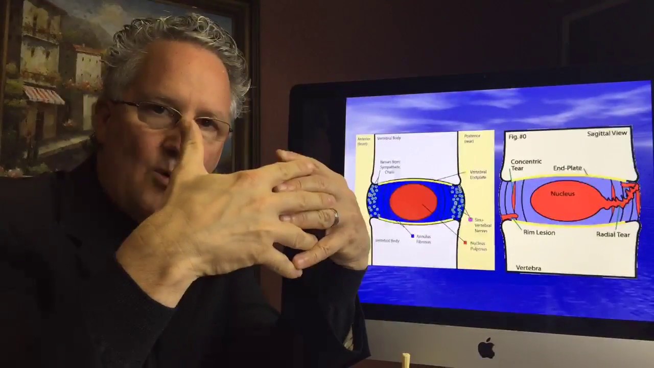 What is the difference between Herniated Disc and a Bulging Disc
