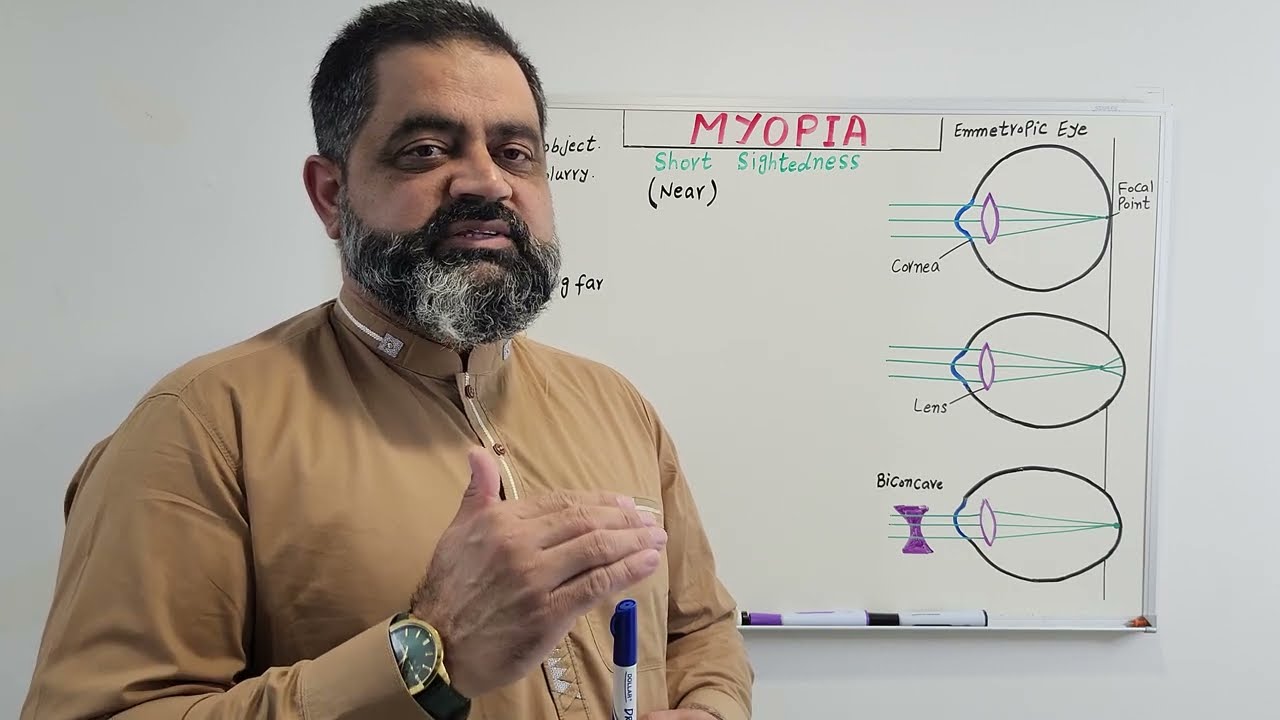 Myopia Urdu/Hindi medium @Prof Masood fuzail #myopia #short-sightedness #nearsightedness